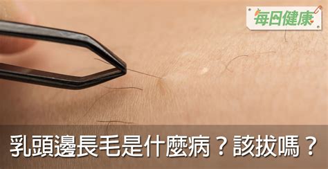 奶頭旁邊長毛|乳頭邊長了毛，是什麼病？該不該拔？讓名醫一次解釋給您聽｜每